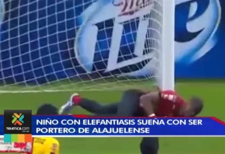 Niño con elefantiasis sueña con ser portero de Alajuelense