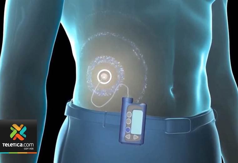 Tecnología se convertirá en la mejor ayuda para los diabéticos