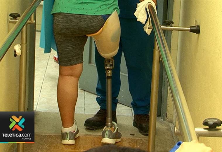 En el 2017 la CCSS entregó 2.117 prótesis para amputados