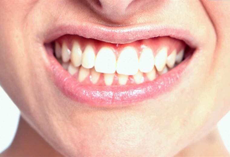 Sepa todo sobre el bruxismo