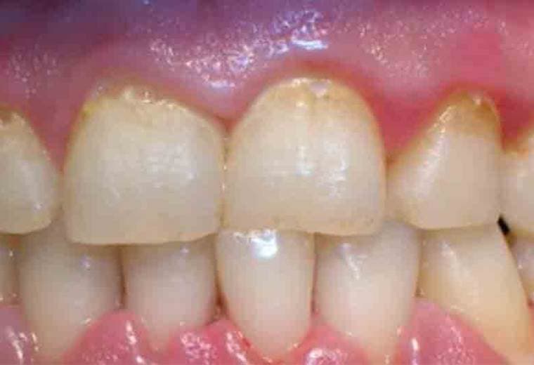 ¿Sabía usted que su boca alberga millones de bacterias?