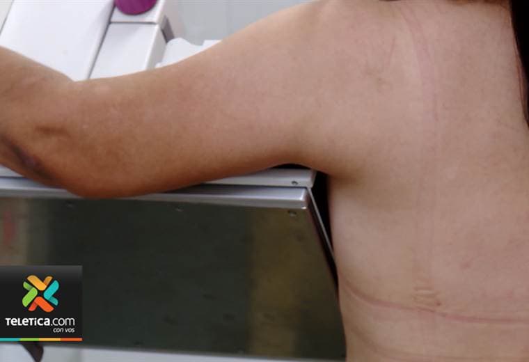 50 mujeres de escasos recursos recibieron mamografías gratis