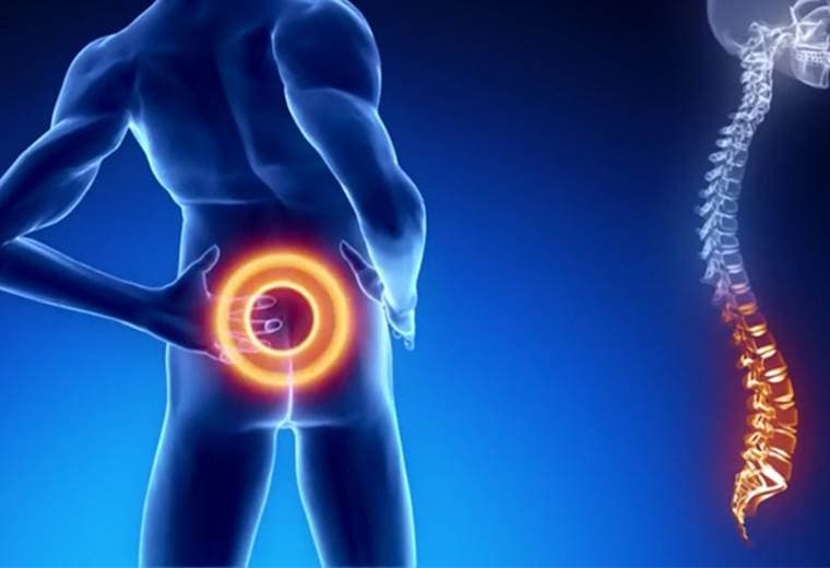 Causas y tratamientos de los dolores de hernia discal