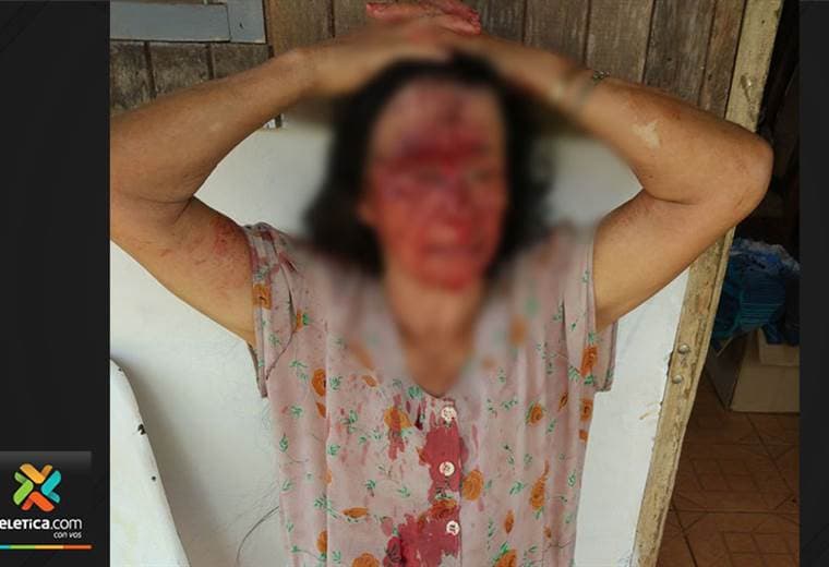 Adultos mayores fueron brutalmente agredidos durante asalto en San Carlos