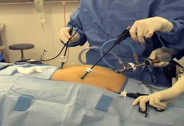 ¿Cuáles males se pueden tratar con cirugía laparoscópica?