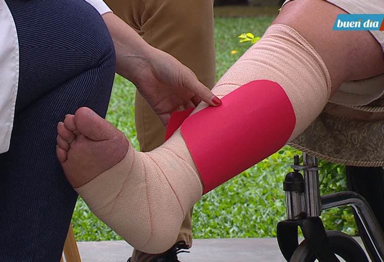 Hablamos sobre tratamiento contra úlceras venosas