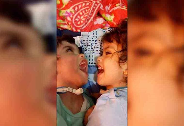 Mamá de siameses Samuel y Ezequiel publica primera foto de ambos