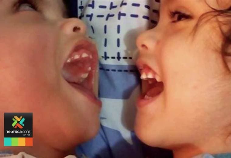 Madre de Samuel y Ezequiel publica en redes sociales primera foto de los siameses separados
