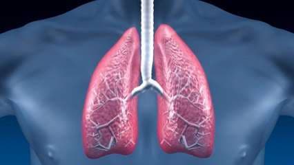 Fibrosis pulmonar