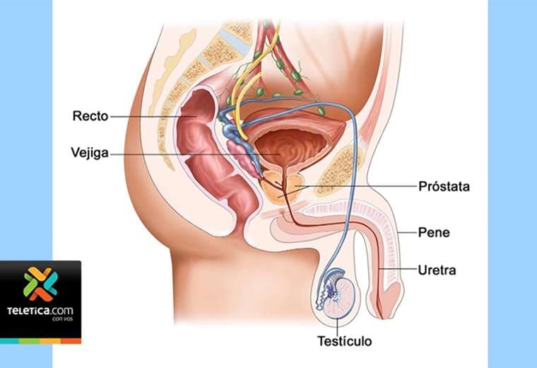 Hombres mayores de 40 años podrán hacerse examen de la próstata sin costo alguno y sin cita previa
