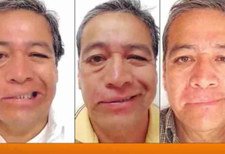 ¿Qué es el botox y de donde proviene?