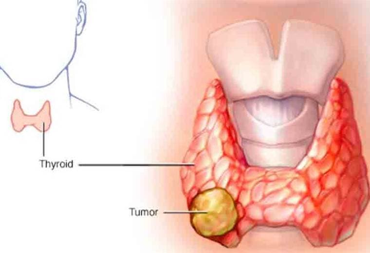 ¿Cuál es la función que tiene la tiroides?