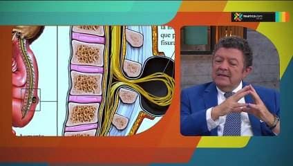Espina bifida oculta y complicaciones