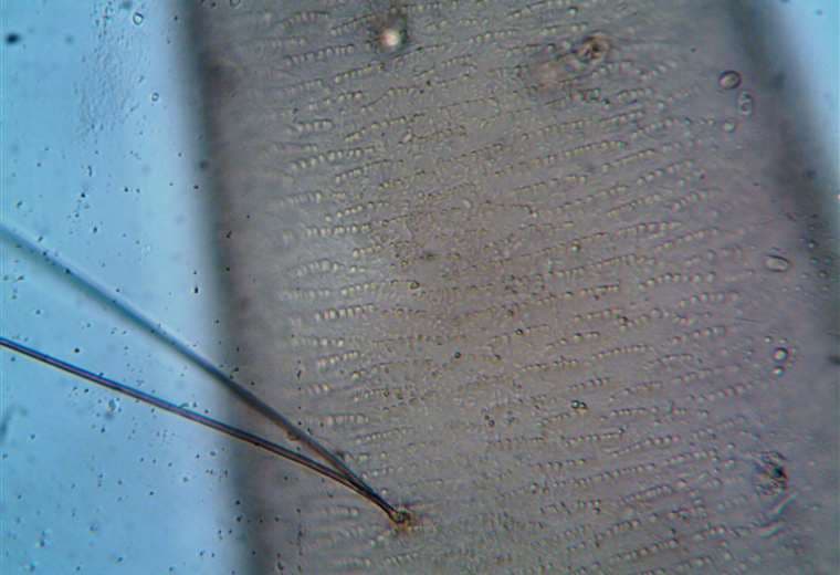 ¡Cuidado! Parásito de la leishmaniasis visceral también puede enfermar a humanos