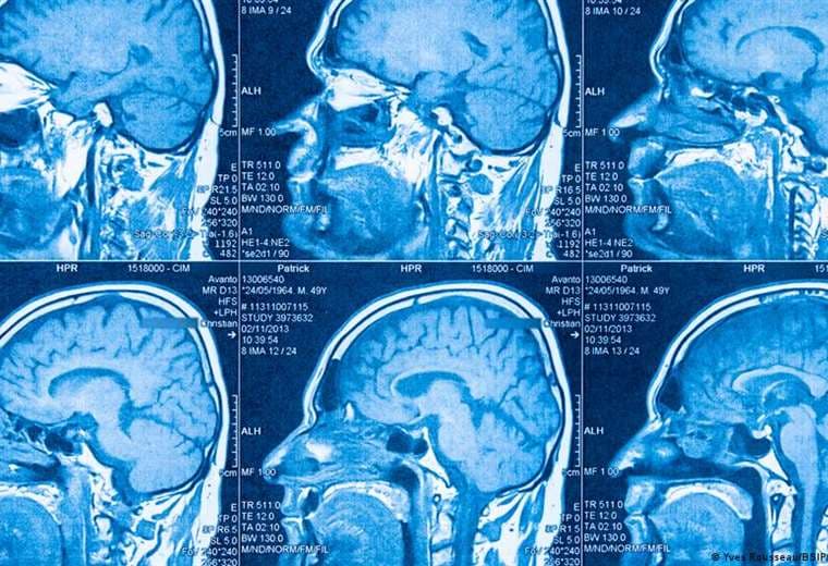 Científicos identifican dos subtipos diferentes de autismo en el cerebro