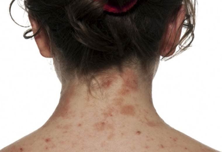 Problemas de la piel