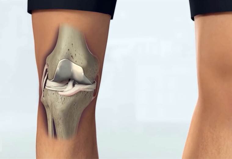 Conozca las lesiones más comunes en las rodillas