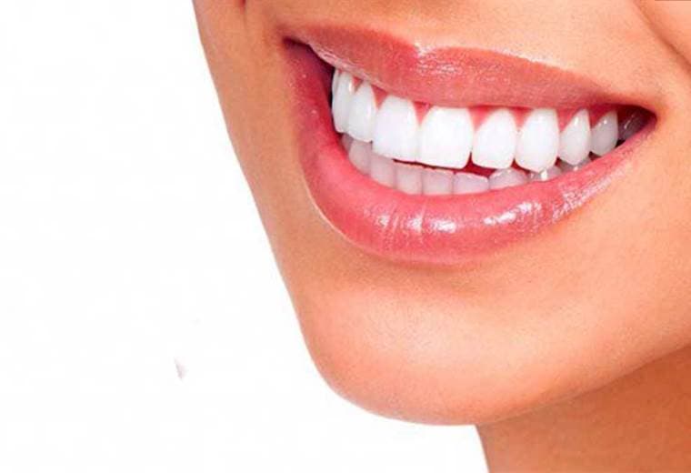 Tips para el adecuado blanqueamiento de sus dientes