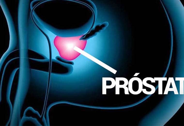 Cáncer de próstata: Causas, consecuencias y forma de detectarlo
