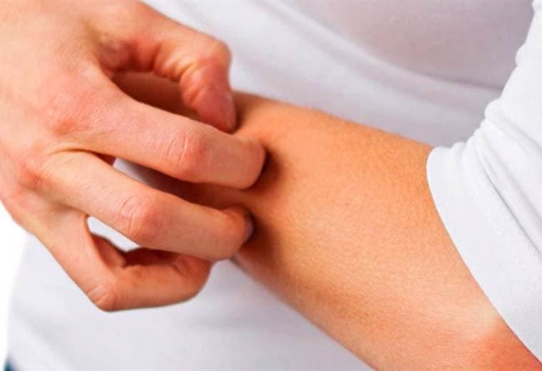 Dermatitis más comunes, sus causas, síntomas y tratamientos
