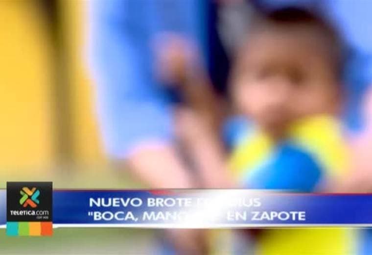 Nuevo brote de virus ‘boca, mano, pie’ se registró en Zapote