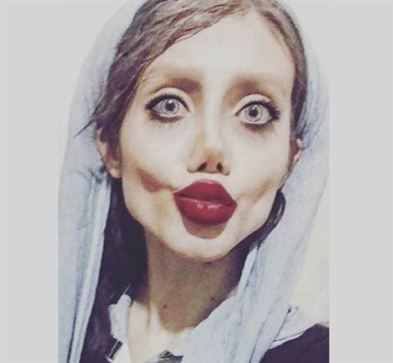Mujer iraní se operó más de 50 veces para parecerse a Angelina Jolie.