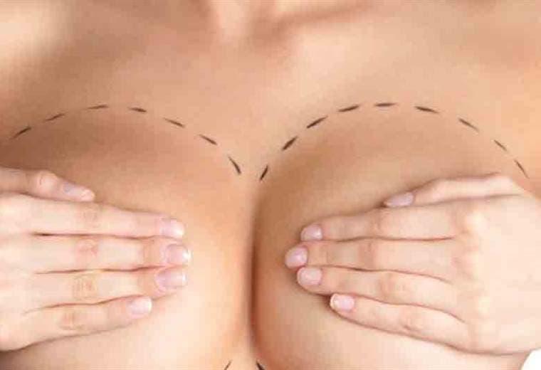 Cirugía estética de mamas: ¿qué consideraciones hay que tener?