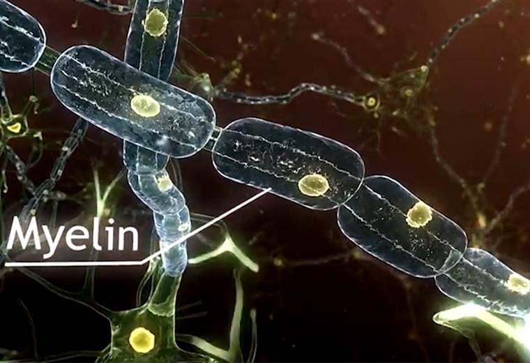 ¿Qué es la esclerosis múltiple?