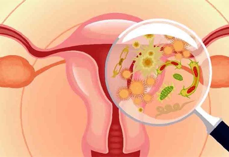 ¿Qué es la vaginitis y cómo se puede tratar?