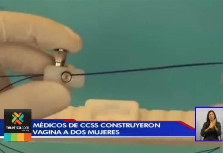 Médicos del San Juan de Dios construyeron la vagina a dos mujeres que nacieron con un trastorno
