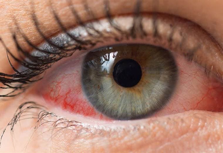 Conozca como la artritis puede llegar a afectar los ojos y la boca