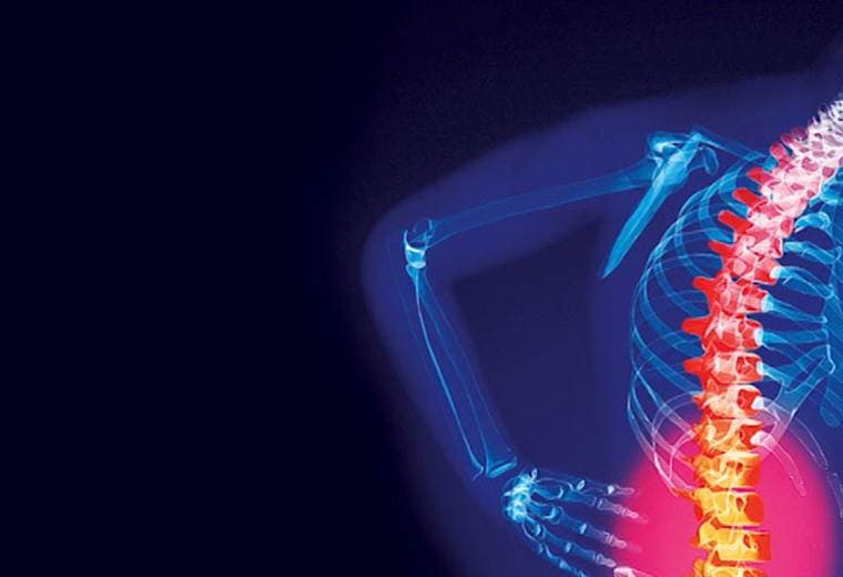 Hablamos sobre fracturas en la columna vertebral por osteoporosis