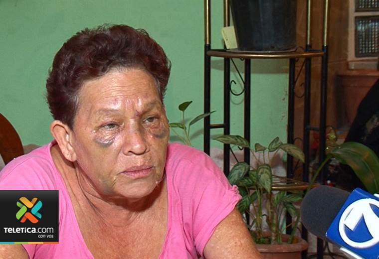 Anciana fue brutalmente golpeada por sus familiares; asegura que no recibió apoyo de las autoridades