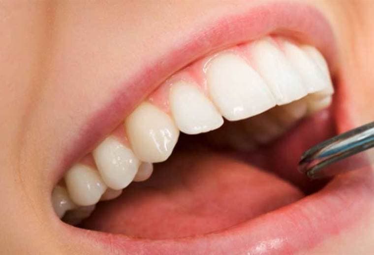 ¿Cómo podemos darle un mantenimiento correcto después de un tratamiento a nuestros dientes?