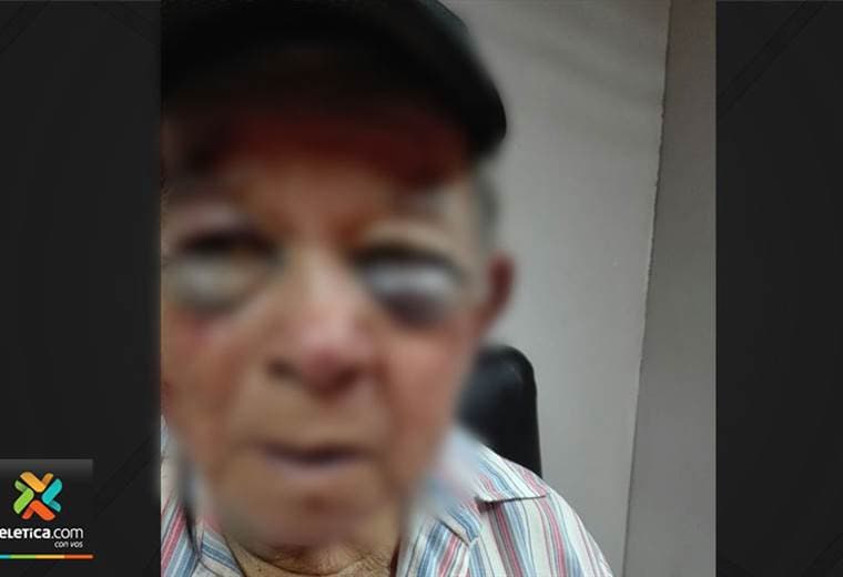 Adultos mayores fueron brutalmente agredidos durante asalto en San Carlos