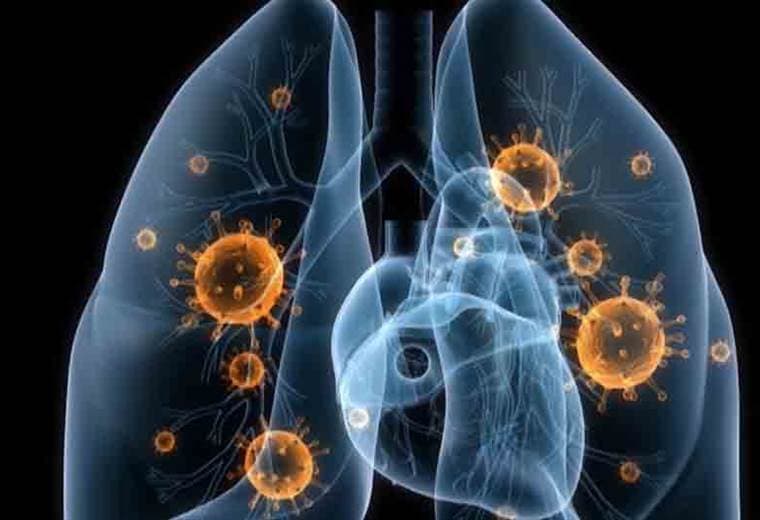 ¿Cómo se manifiesta el cáncer de pulmón y a quiénes afecta?