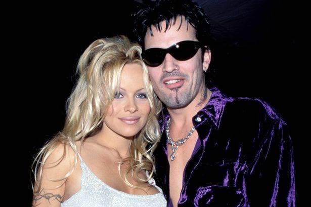 Tommy Lee y Pamela Anderson. 
