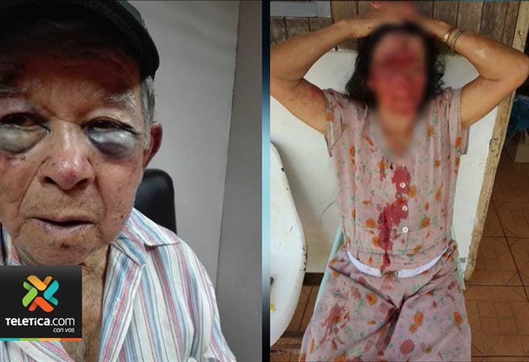 Dueño de pulpería atacado durante un asalto en Coopevega cuenta su historia