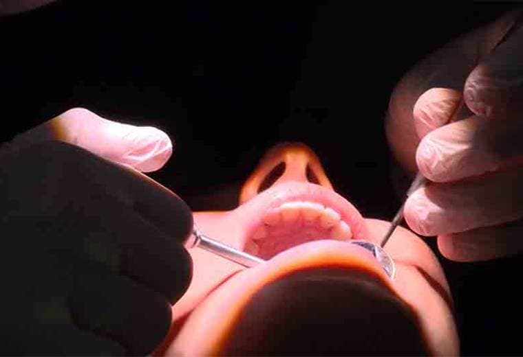 Conozca sobre la periodontitis, las causas y cuidados que debe tener