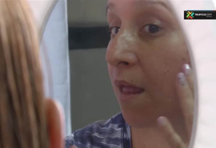 Conozca una nueva técnica con micro-agujas para rejuvenecer el rostro