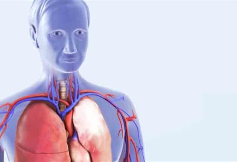 ¿Qué es la embolia pulmonar y a quiénes puede afectar?