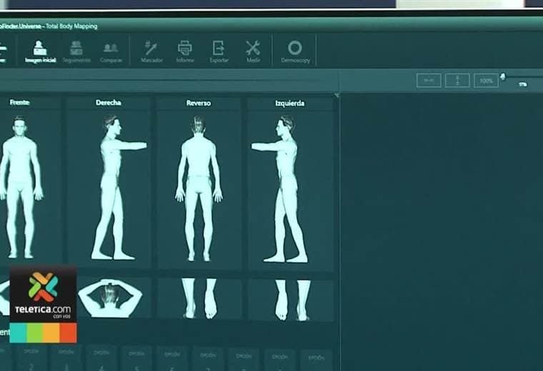 Equipo médico de última tecnología detecta cáncer de piel en minutos