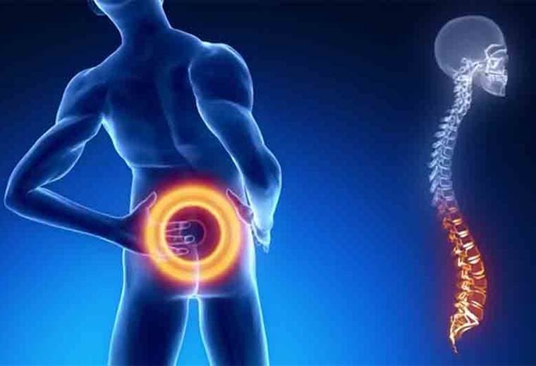 Hablamos acerca del dolor de espalda producido por artrosis espinal
