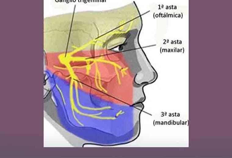¿Cuáles son las causas y tratamientos del dolor facial?