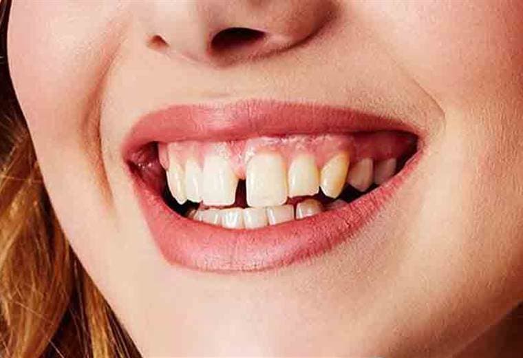 Aprenda sobre los padecimientos más comunes de los dientes y cómo tratarlos