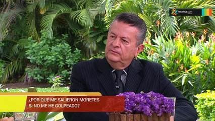 Porque se forma un morete?