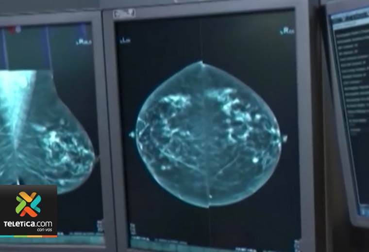 CCSS pide a diputados no quitarle recursos a programas contra cáncer