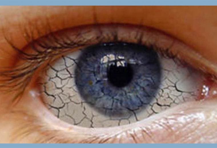 Causas del síndrome del ojo seco y sus complicaciones