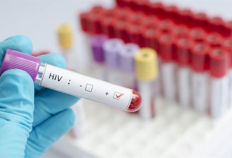 La pandemia de COVID-19 frenó avances en lucha contra el sida