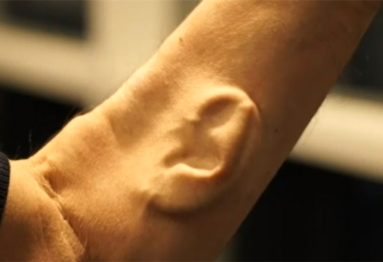 Una oreja dentro de un brazo y cuernos en la cabeza: cómo son los implantes más extremos